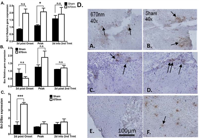Fig.2 670 nm light improves apoptosis in EAE mice. (OA Literature)