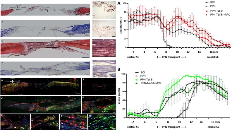 Fig.2 Histological analysis, axonal tracing and axonal regeneration. (OA Literature)