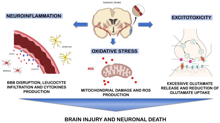 Fig.1 The pathophysiology involved in ischemic stroke. (OA Literature)