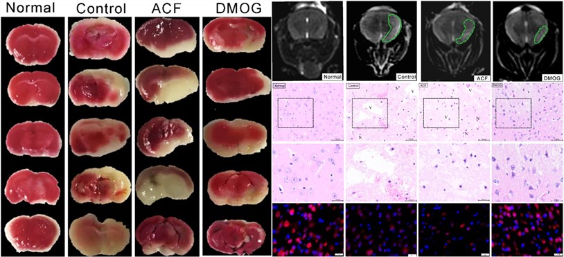 Fig.2 TTC staining, T2W Magnetic resonance image, H&E staining and NeuN immunostaining. (OA Literature)