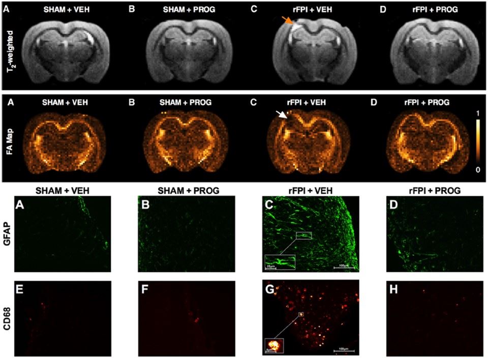 Fig.2 The therapeutic effect of progesterone in rFPI rats. (OA Literature)