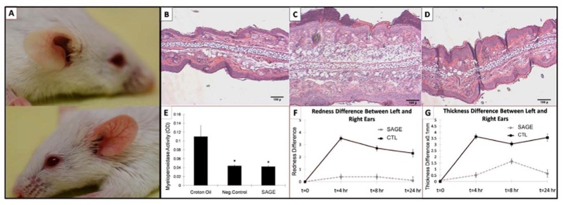 Topical application of SAGE alleviates ear swelling induced by croton oil. (OA Literature)