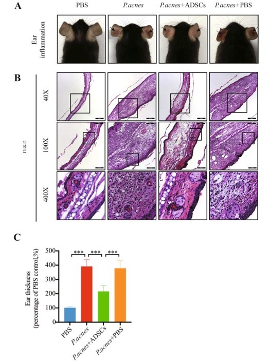 Fig.2 ADSCs reduce skin inflammation in the mouse ear acne model. (OA Literature)