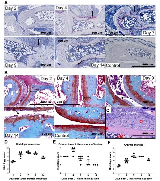 Fig.1 The experimental results of severe arthritis in mice with delayed-type hypersensitivity (DTH) arthritis. (OA Literature)