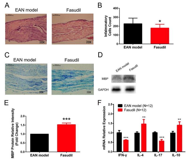 Fig.1 The experimental results of EAN mice treated or not with fasudil. (OA Literature)