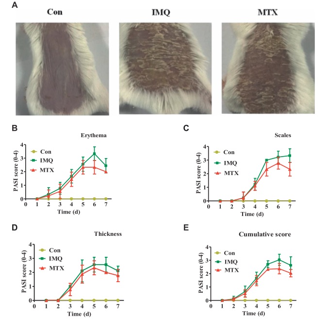 Fig.1 MTX treatment reduced the severity of IMQ induced skin lesions. (OA Literature)