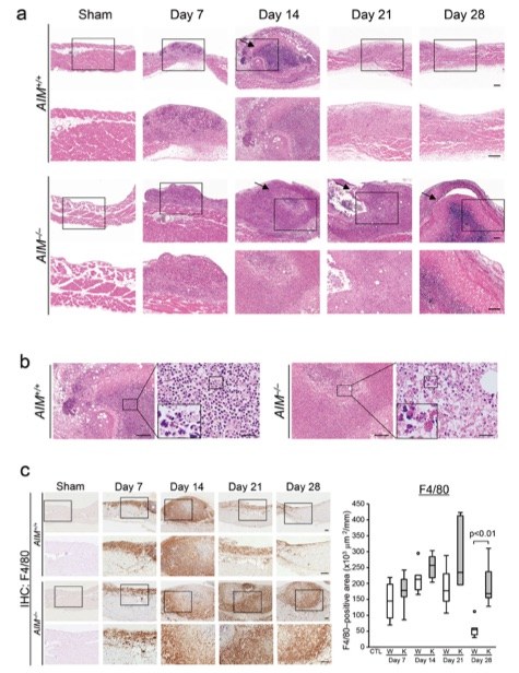 Fig.1 Histopathological alterations in the zymosan induced peritonitis model. (OA Literature)