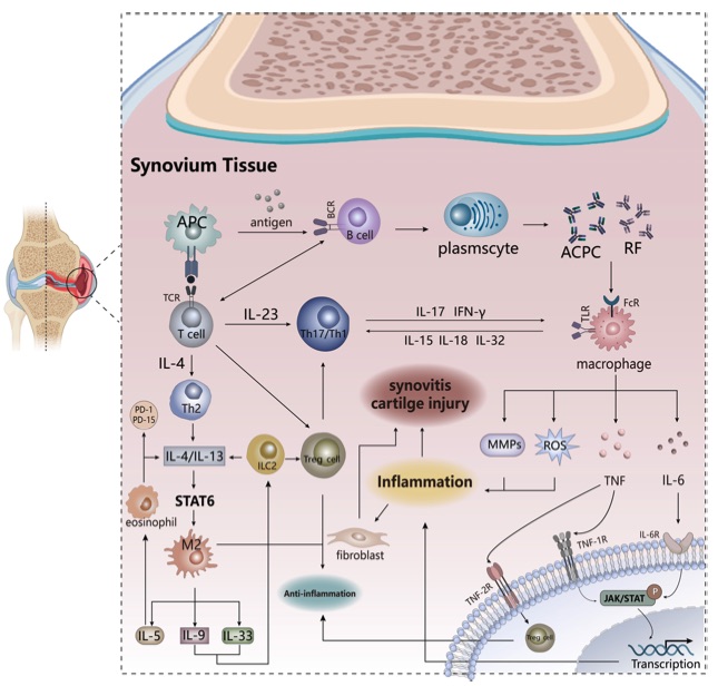Fig.1 Schematic of RA. (OA Literature)
