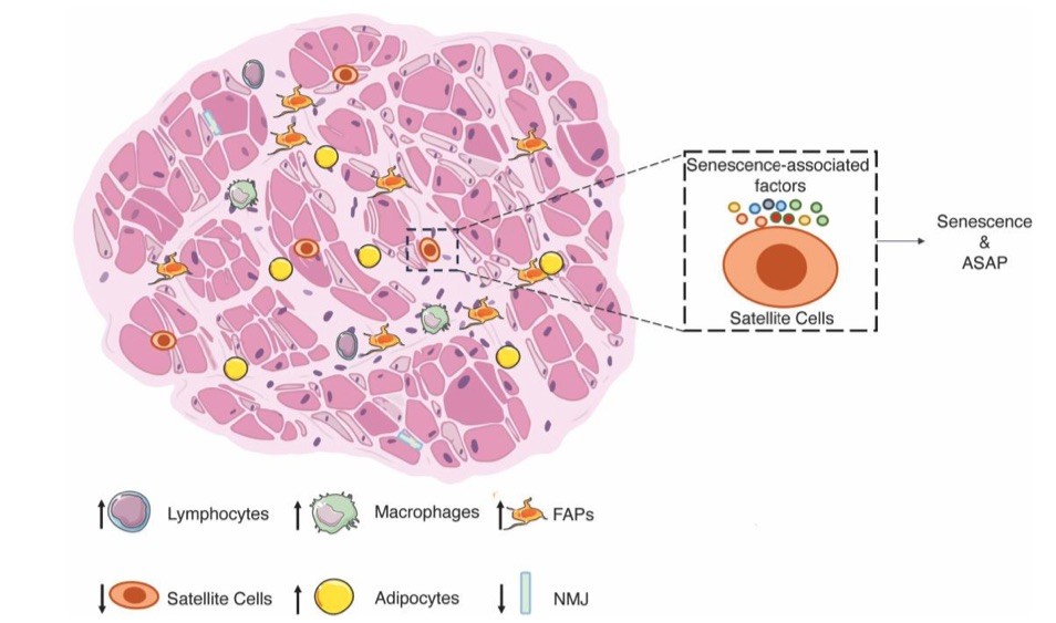 Graphical representation of sarcopenia. (OA Literature)