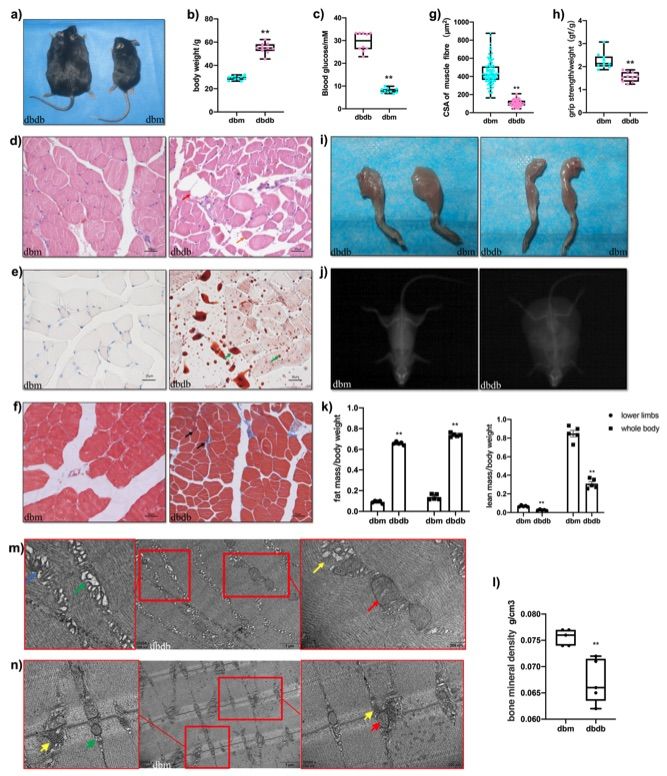 Significant metabolic disturbances, along with muscle mass and strength depletion, and structural alterations, are observed in the diabetic muscle atrophy model using db/db mice. (OA Literature)