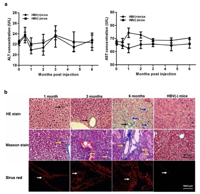  Injection of AAV-HBV leads to chronic liver damage without causing acute inflammation. (OA Literature)