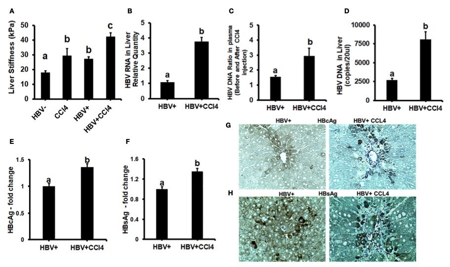 Elevated liver tissue stiffness modulates HBV replication and enhances HBV marker expression in the livers of CCl4-treated HBV<sup>+</sup> transgenic mice. (OA Literature)
