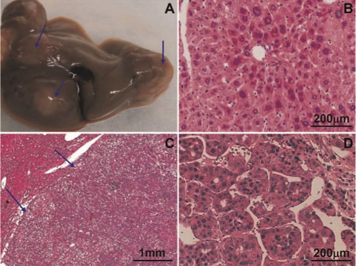 A picture showing hepatocellular neoplasms in Tg05 wild-type HBV transgenic mice. (OA Literature)