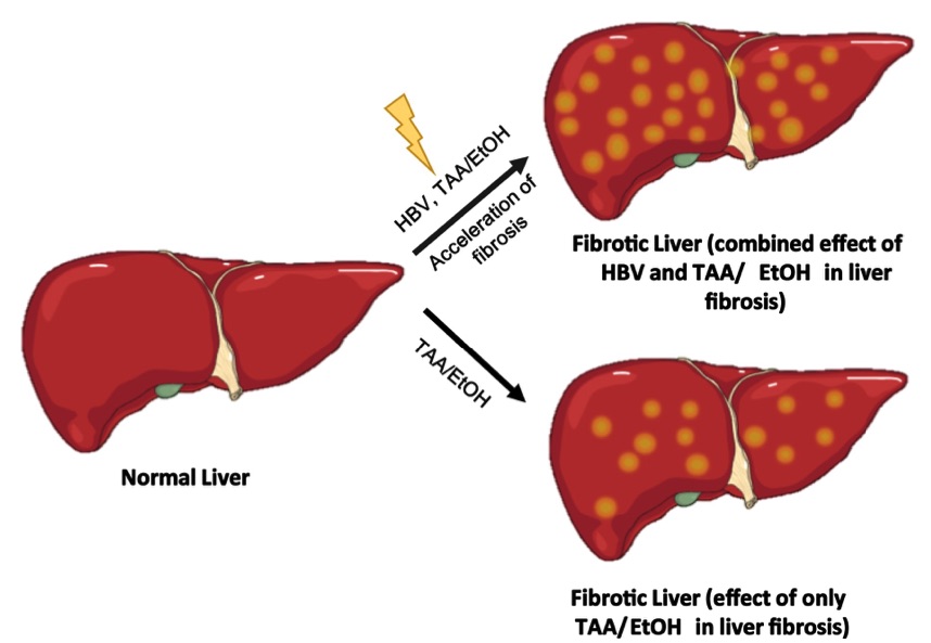 A picture showing the acceleration of hepatic fibrosis in HBV-TAA/EtOH-treated mice. (OA Literature)