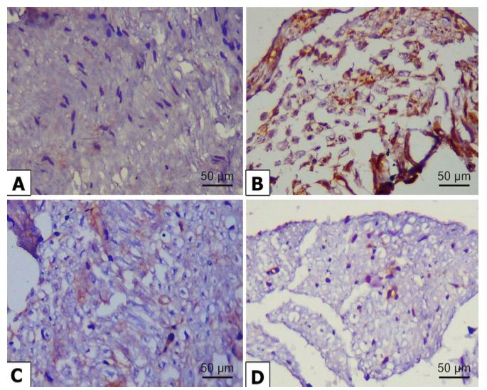 Fig.1 Microscopic images showing the levels of p62 immuno-expression in the sciatic nerve fibers of rats with alloxan-induced diabetes. (OA Literature)