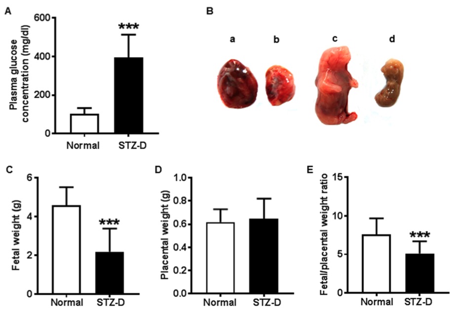 Fig.1 Pre-existing diabetes resulted in fetal growth restriction and reduced placental efficiency in rats with streptozotocin-induced diabetes (STZ-D). (OA Literature)