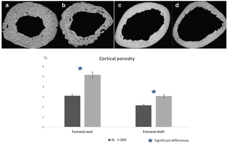 Fig.1 A picture showing the cortical porosity between a Zucker diabetic fatty (ZDF) rat and a Zucker lean ZL rat. (OA Literature)