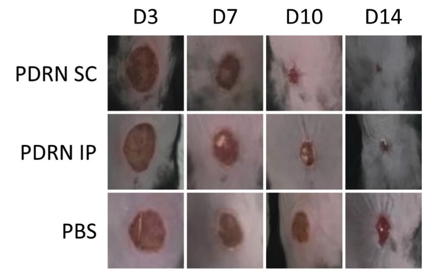 Fig.1 A picture of the diabetic wounds. (OA Literature)