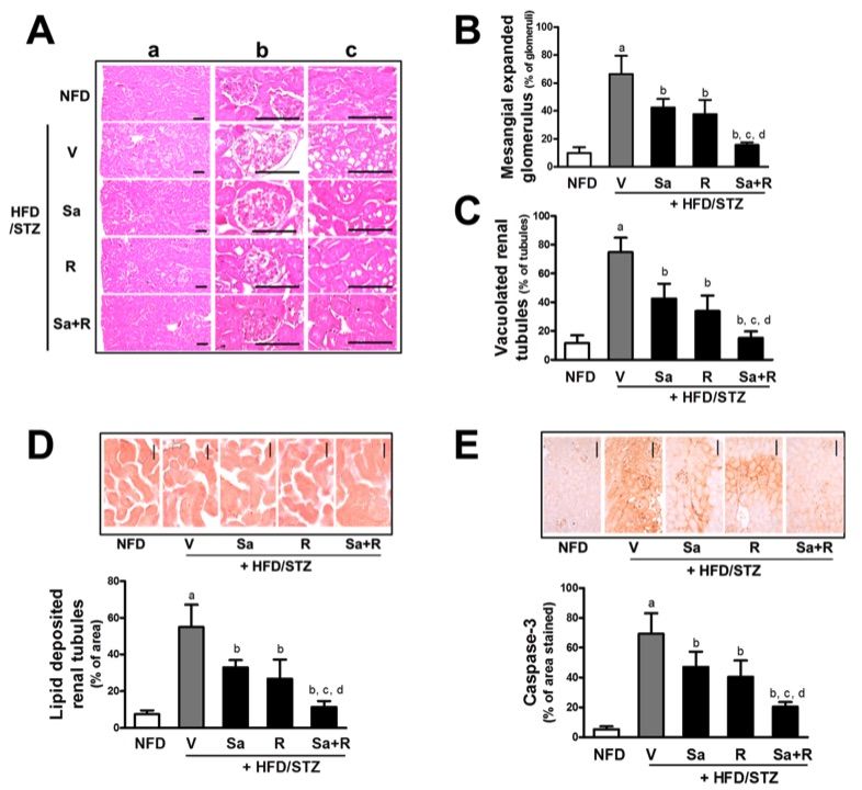 Fig.1 A picture showing the effects of sarpogrelate and rosuvastatin on histomorphological changes in HFD/STZ mice. (OA Literature)