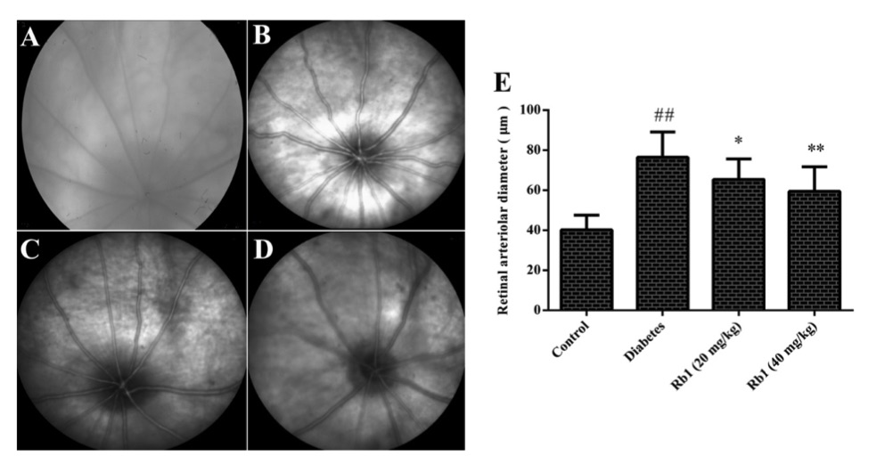 Fig.2 A picture showing the effect of ginsenoside Rb1 on the diameter of retinal vessels and fundus photography. (OA Literature)