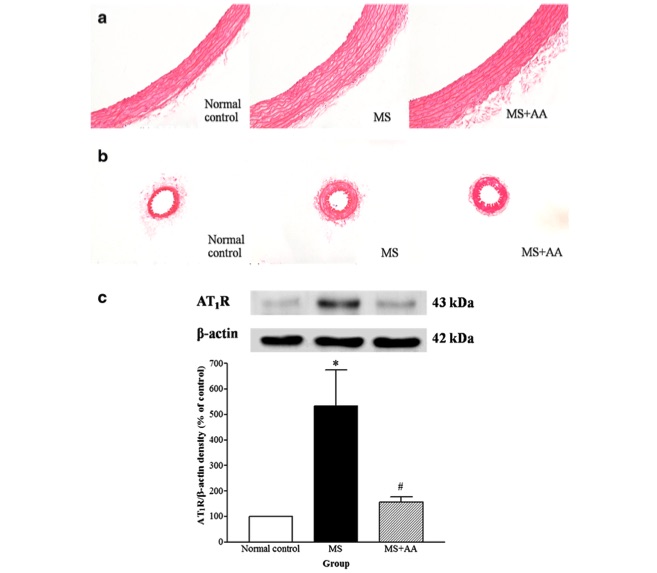 Fig.1 The effects of asiatic acid on vascular remodeling and the expression of AT1 receptor protein in the thoracic aorta. (OA Literature)