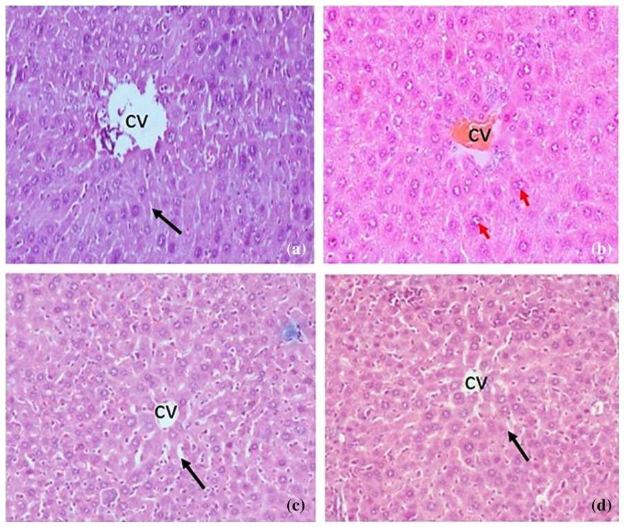 Fig.2 Histological picture of liver samples. (OA Literature)