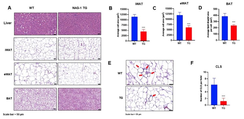 Fig.2 The impact of curcumin treatment on histopathological alterations in the livers of rats subjected to a high-fat diet and subsequent streptozotocin administration. (OA Literature)