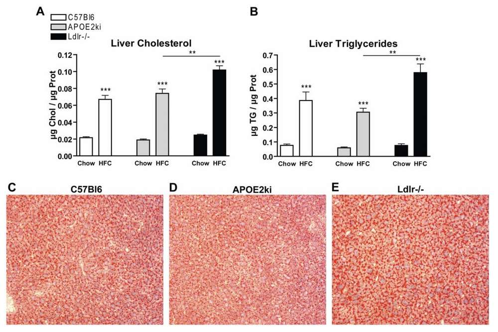 Fig.2 A picture showing the parameters of hepatic steatotis. (OA Literature)