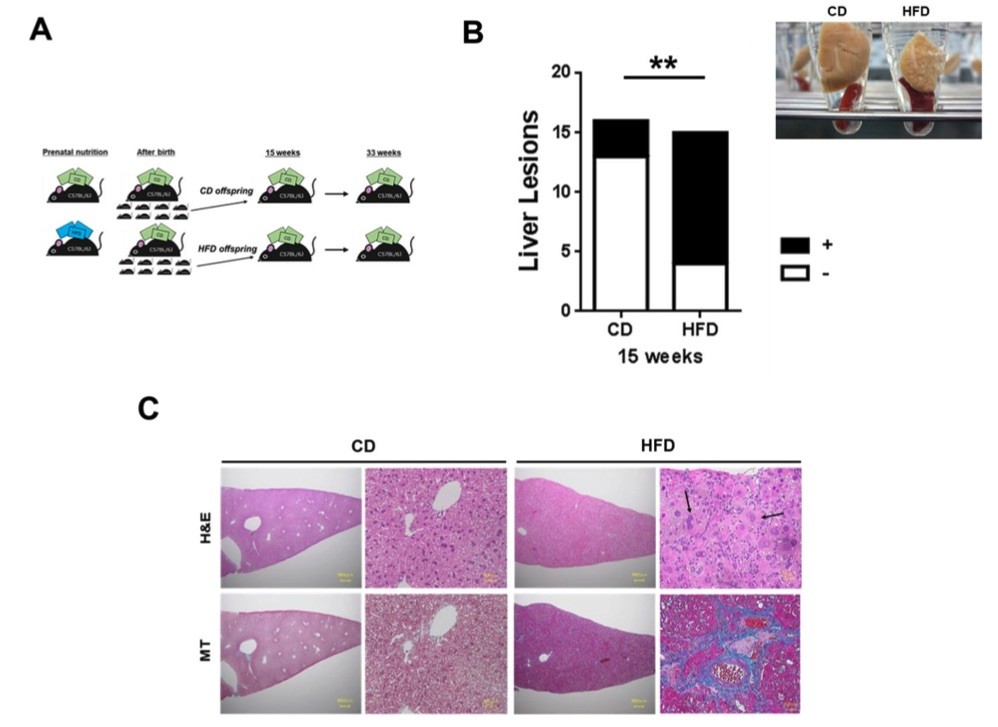 Fig.2 A picture showing maternal HFD consumption induces hepatic steatosis in offspring. (OA Literature)