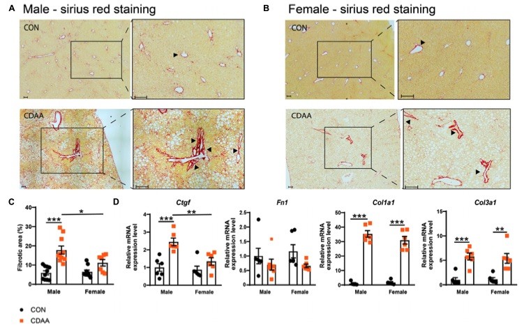 Fig.2 A picture showing hepatic fibrosis in CDAA induced NASH. (OA Literature)