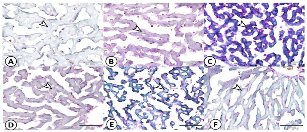 Fig.2 A picture of hepatic tissues of different treated groups. (OA Literature)