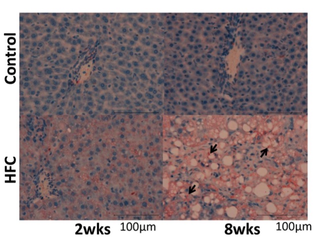 Fig.1 A picture of p62 immunostaining of samples from SHRSP5/Dmcr rats fed control and HFC diets for 2 and 8 weeks. (OA Literature)