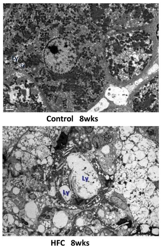 Fig.2 Electron microscopic image of giant lysosomes. (OA Literature)