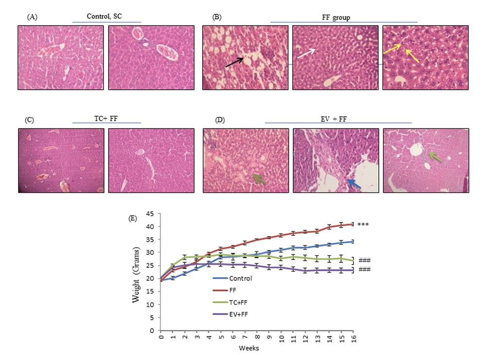 Fig.2 The FF diet induced steatosis, histological changes, and lipid droplet accumulation in the livers of C57BL/6J mice. (OA Literature)