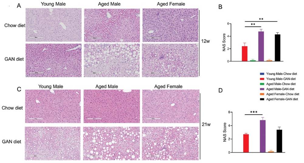Fig.2 GAN diet induced Nonalcoholic Steatohepatitis in mice. (OA Literature)