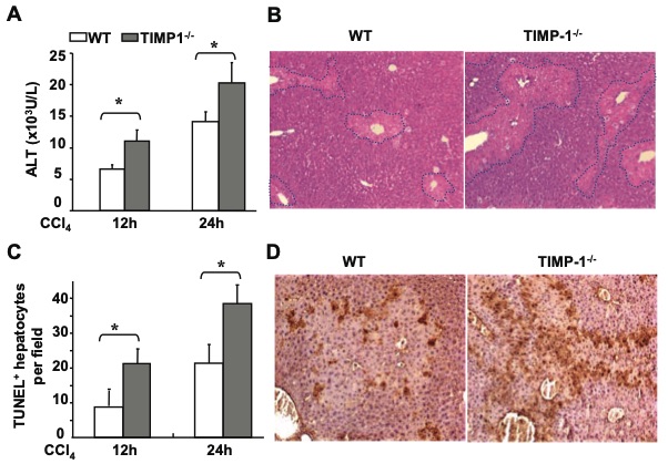 TIMP-1-/- mice exhibit increased vulnerability to acute liver injury induced by CCL4. (OA Literature)