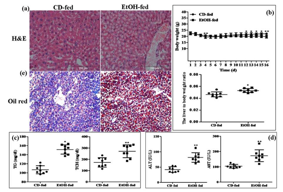 Histopathological features in a murine model of alcoholic liver disease (ALD). (OA Literature)