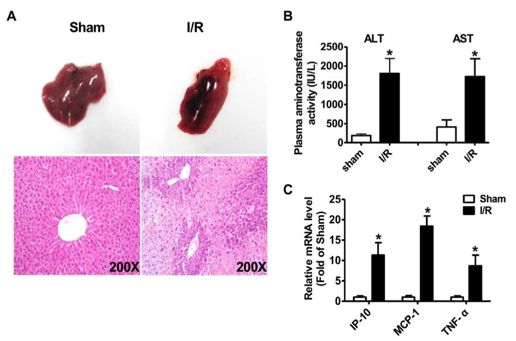 A picture showing the characterics of liver injury after ischemia/reperfusion treatment. (OA Literature)