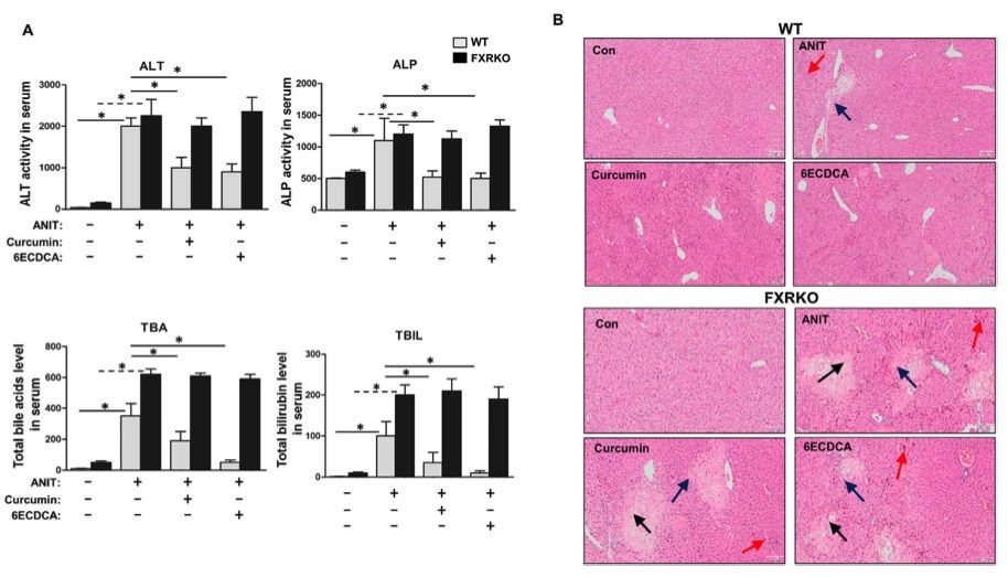 Curcumin mitigated ANIT induced liver injury and cholestasis through FXR activation, as demonstrated by biochemical and histological analyses. (OA Literature)