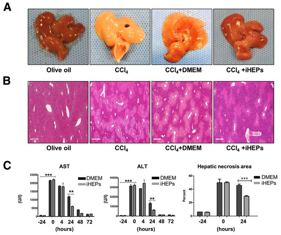 CCl4 induced liver acute injury model. (OA Literature)