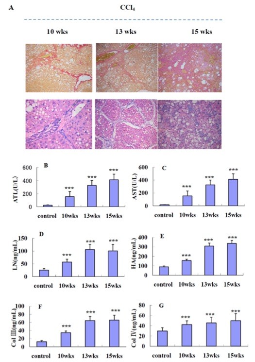Examination of liver histology and serum biochemistry at different stages in CCl4 model rats. (OA Literature)