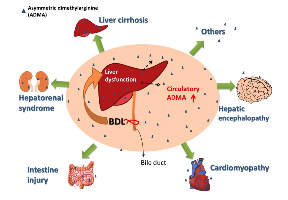 The impact of elevated circulating asymmetric dimethylarginine (ADMA) on multi-organ injury in the bile duct ligation rat model. (OA Literature)
