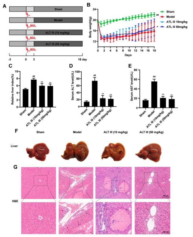A picture showing that ATL III inhibited BDL induced liver injury. (OA Literature)