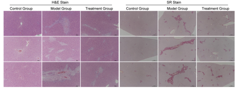 Liver tissue histopathology images of SD rats following 4 weeks of ANIT induction. (Creative Biolabs Original)