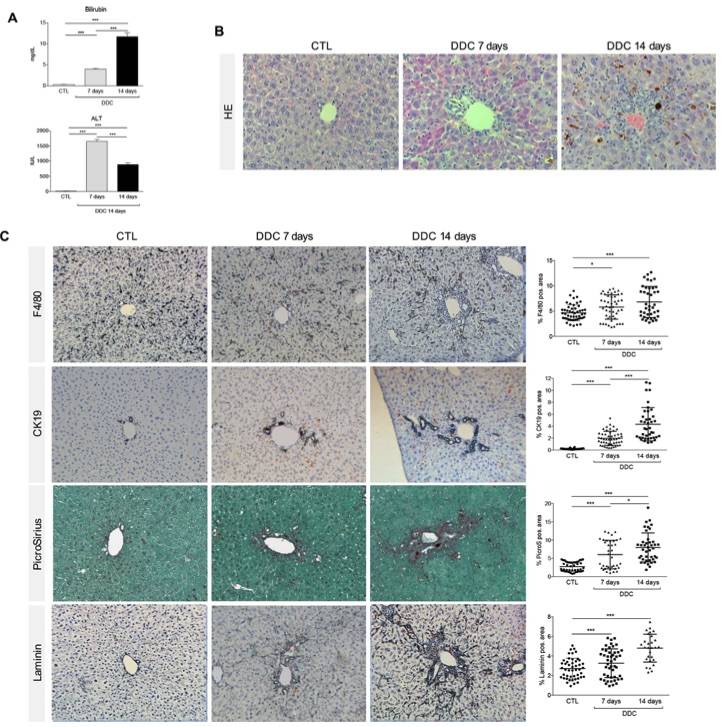 A picture showing that the DDC diet induces biliary damage in mice. (OA Literature)