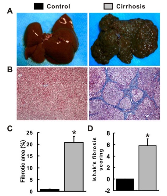 A picture showing the establishment of a liver cirrhosis model. (OA Literature)