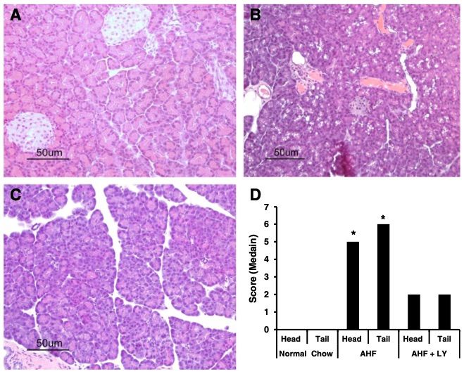 A picture showing AHF diet induced chronic pancreatitis pathology and protection by LY3038404 HCl. (OA Literature)