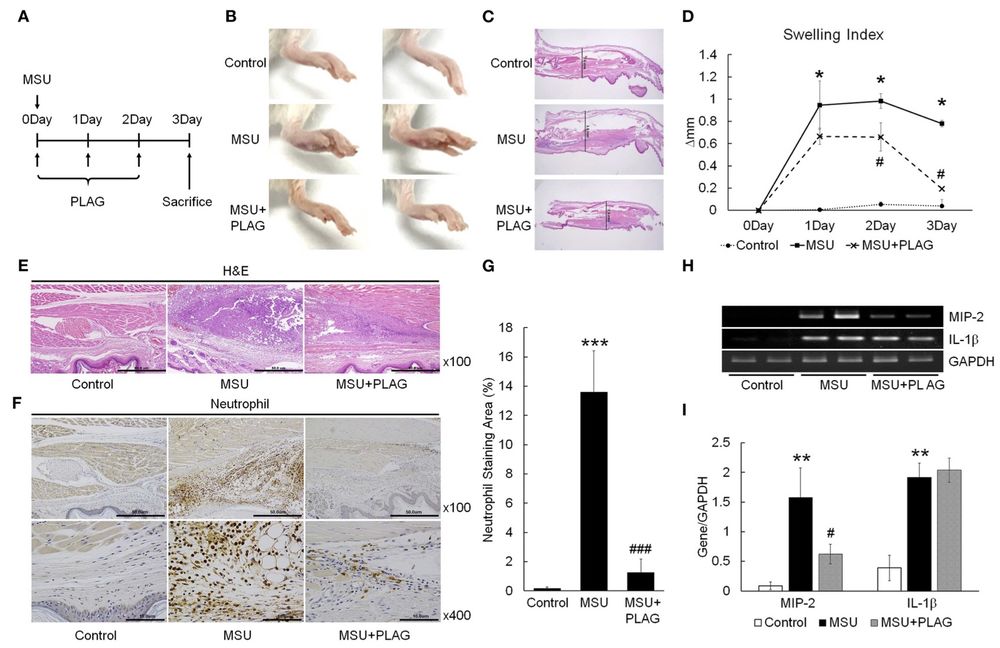 PLAG reduces MSU induced gouty inflammation by decreasing neutrophil infiltration in affected tissues. (OA Literature)