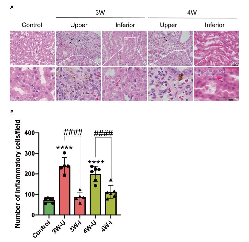 A picture showing intrarenal MSU injection caused localized renal tubular damage and an increase in inflammatory cell infiltration. (OA Literature)