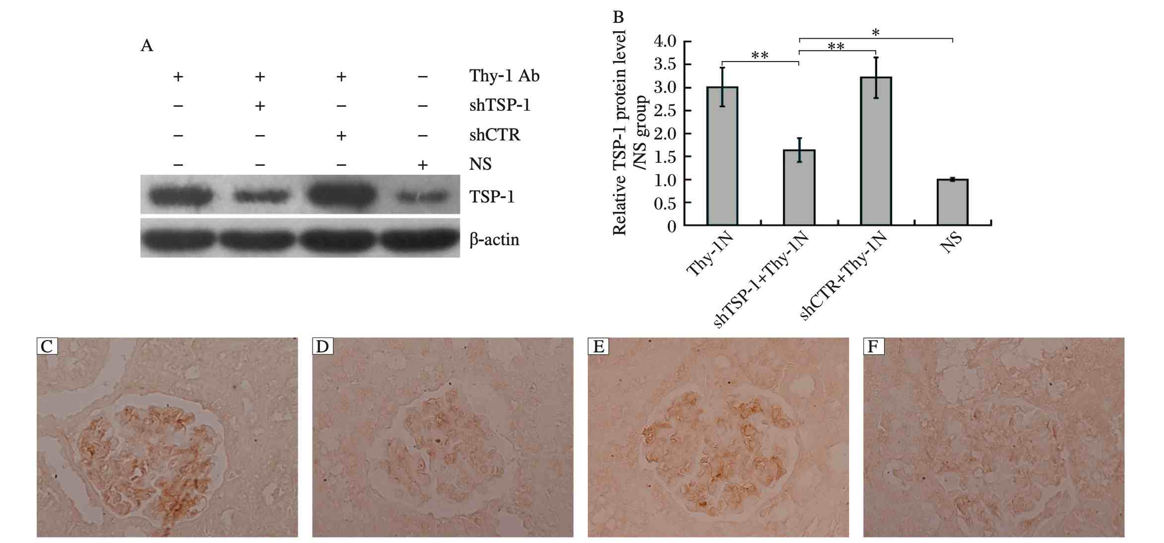Impact of shTSP-1 on renal TSP-1 expression in Thy-1 nephritis rat model. (OA Literature)